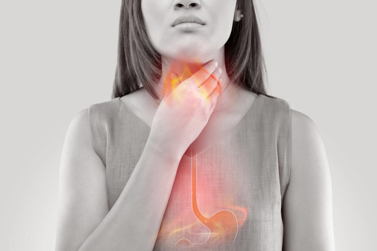 Why Roux en Y Gastric Bypass Improves Heartburn